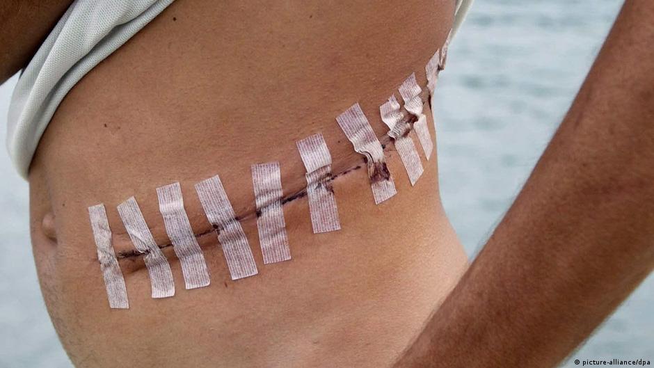 Illegal organ trafficking in India DW 08/04/2021