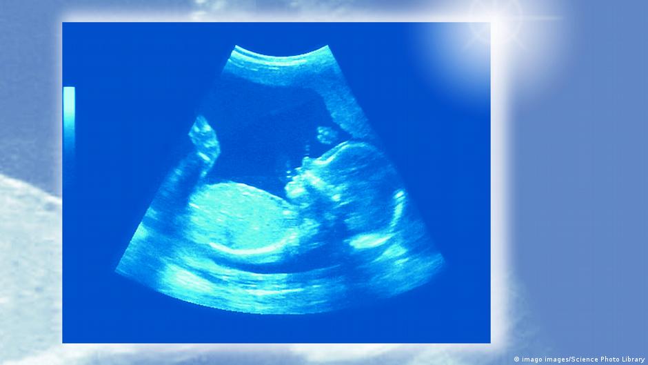 Was Sieht Man Beim Ultraschall Vom Bauch Pregnant Center Informations