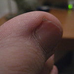 My toe