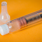 Macro Mondays : Remedy