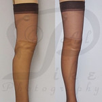 Wood artificial leg (prosthesis) for above knee amputee