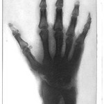 This image is taken from United States Naval Medical Bulletin Vol. 8, Nos. 1-4, 1914