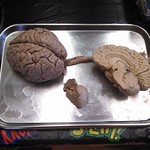 Brains