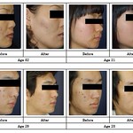 FW: คุณใช้สบู่อะไรอย ู่ ผิวหนังของคุณแข็ง แรงแล้วหรือยัง!?