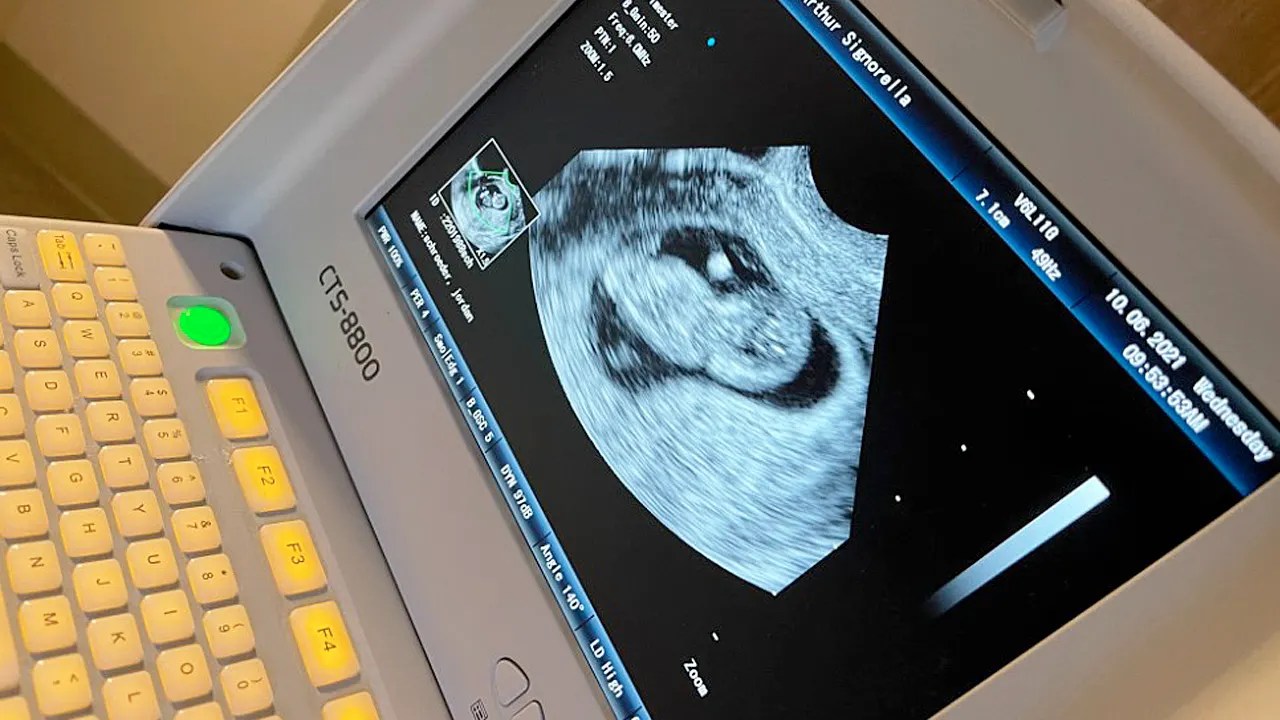 From conception to birth A look at the stages of pregnancy Fox News