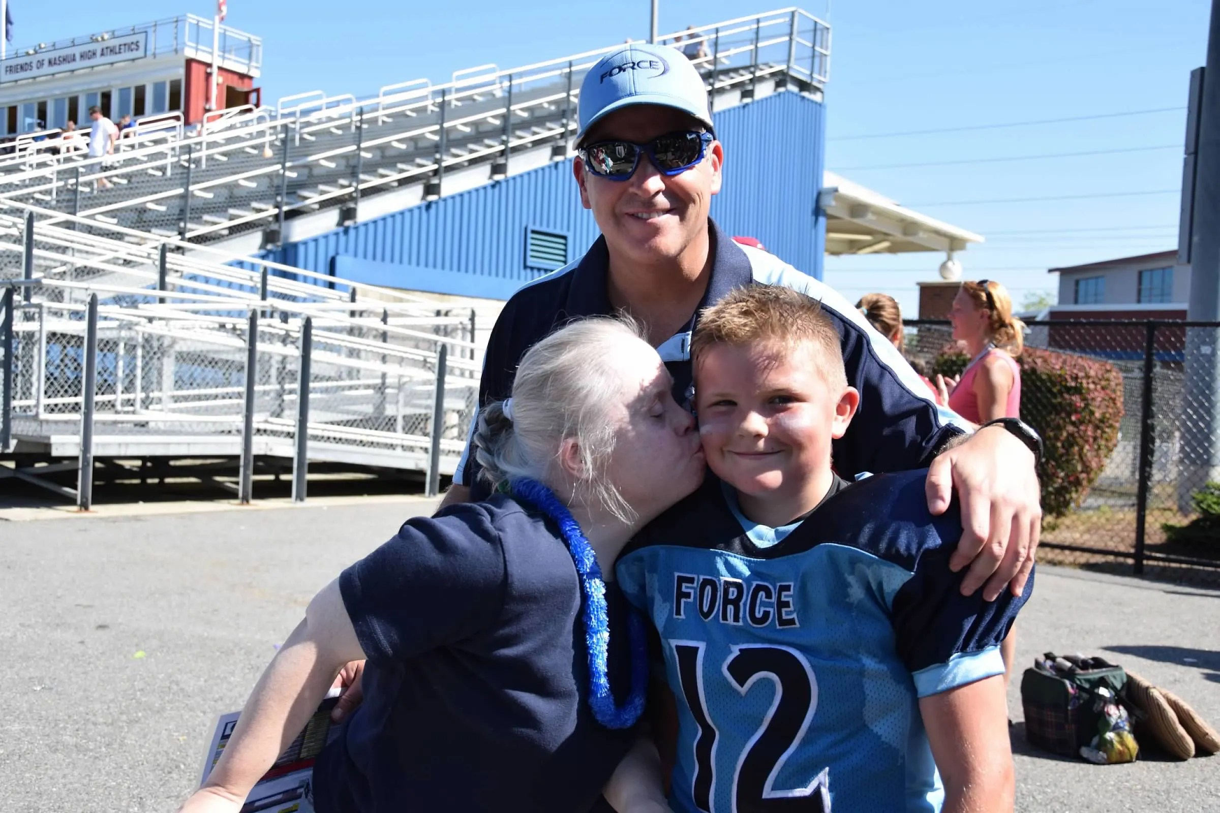 3 key lessons my sister with Down syndrome taught me about life Fox News