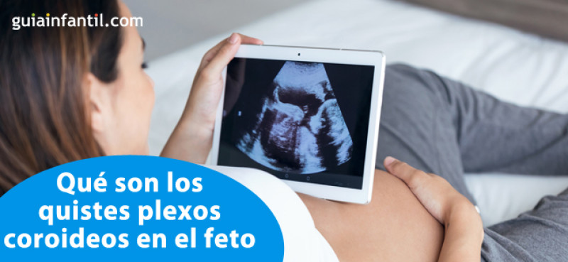 Qué son los quistes plexos coroideos y cómo se detectan en el feto
