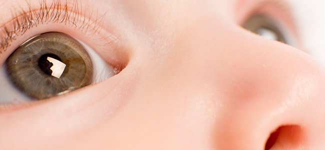 Astigmatismo en bebés y niños. ¿Qué es?