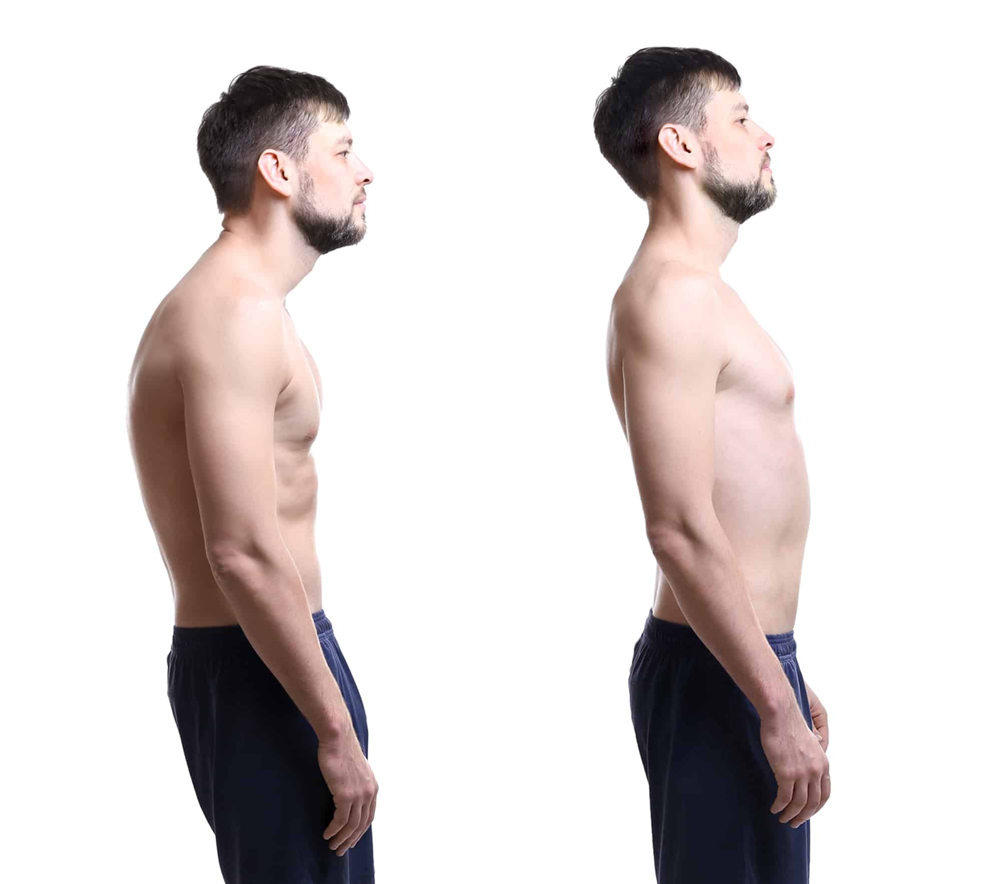 How to Fix Rounded Shoulders ManagerUp