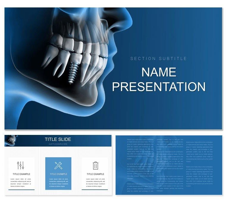 Dental Implants Procedure PowerPoint Template Professional Infographic