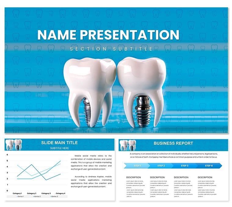 Dental Implant PowerPoint Template Presentation