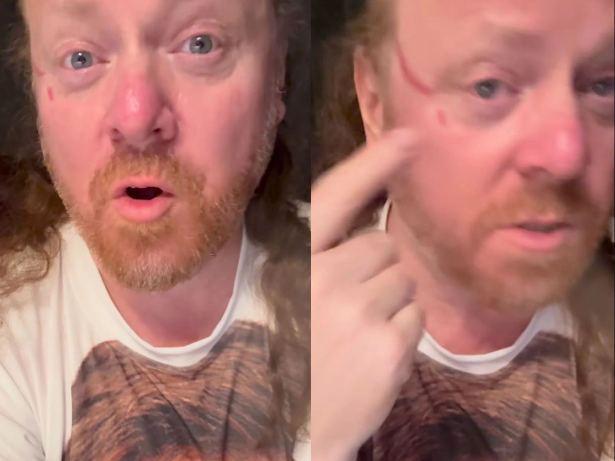 Keith Lemon actor Leigh Francis clawed in face by overzealous fan during DJ set