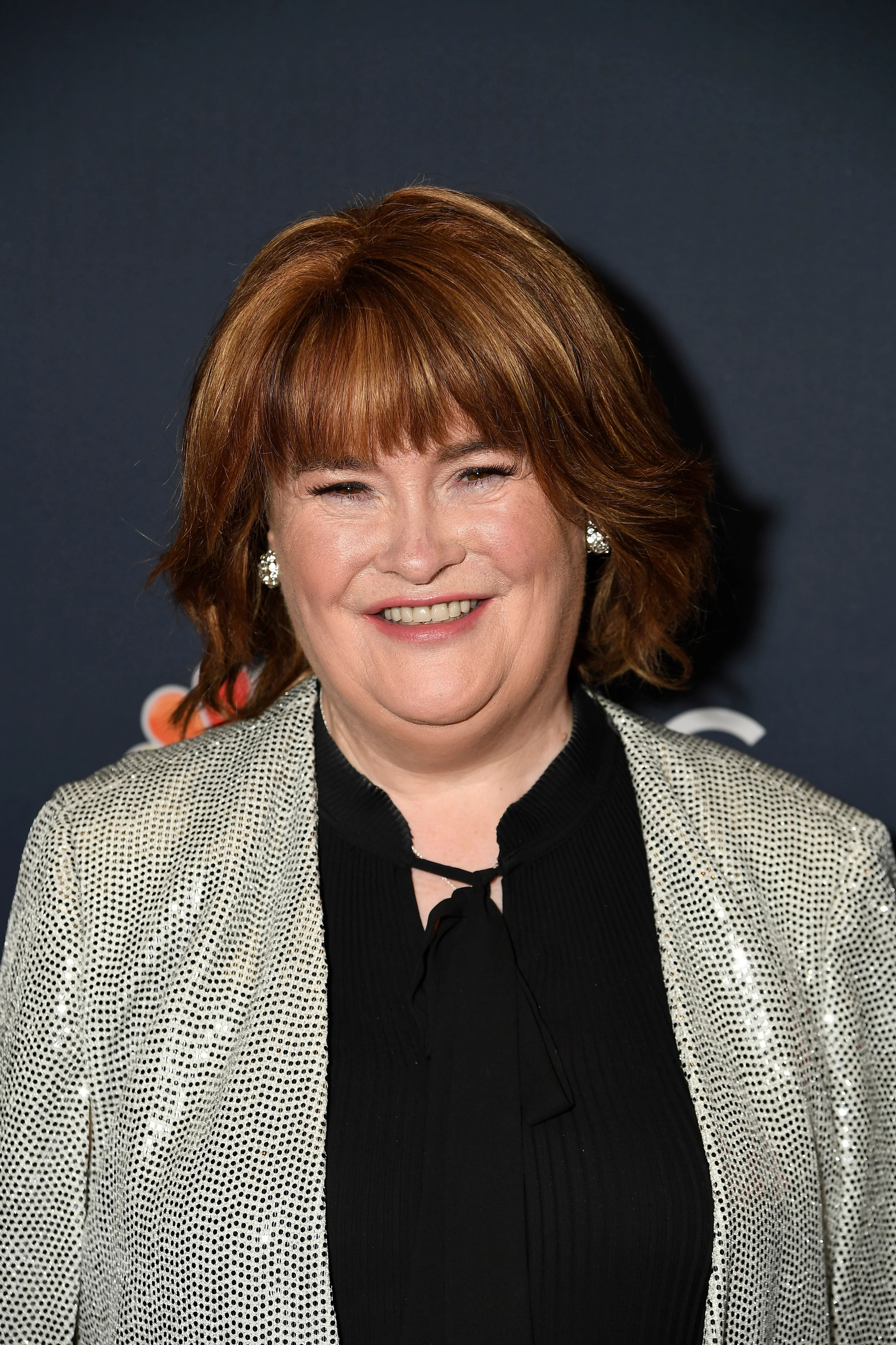 Susan Boyle drops out of US comeback gig due to manager’s dental procedure