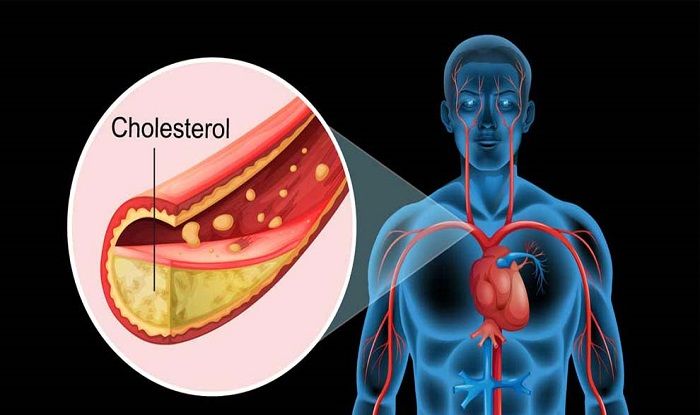 Here is Why You Must Maintain Balance Between Good And Bad Cholesterol Level