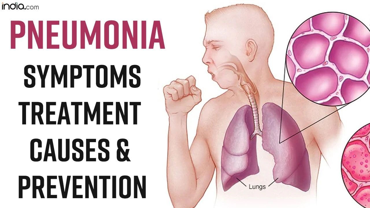 World Pneumonia Day 2022 What Causes Pneumonia? Symptoms And