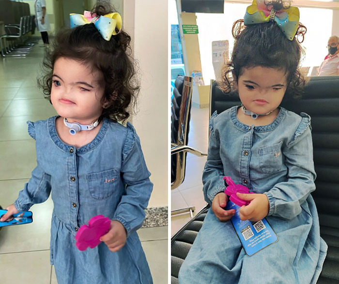 50 Beautiful Photos Of People Appreciating Their Unique Genes And