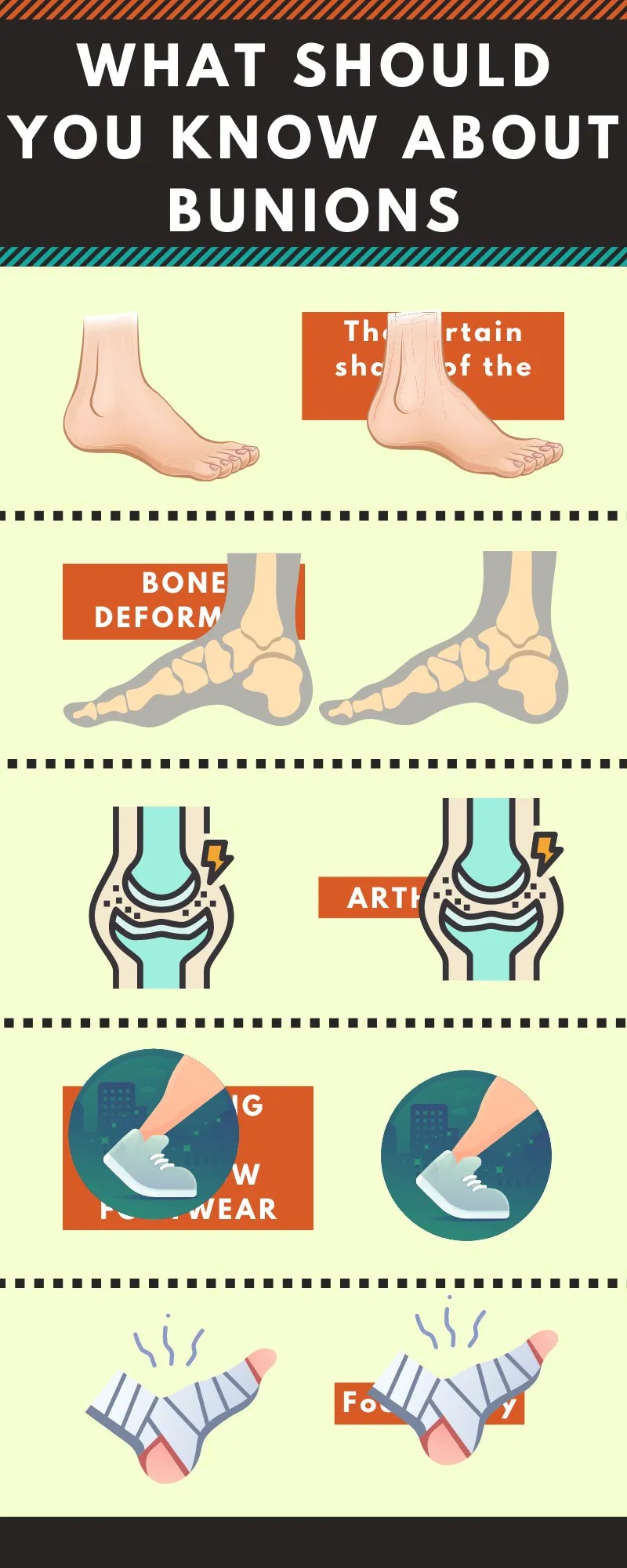 What Should You Know About Bunions