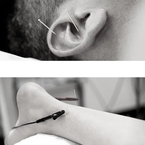 Helen McQue Acupuncture