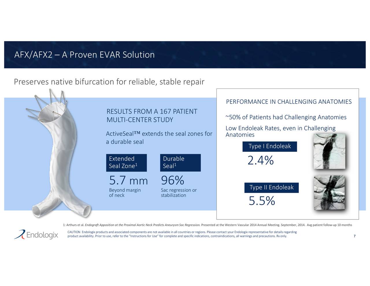 Endologix (ELGX) Investor Presentation Slideshow (NASDAQELGX