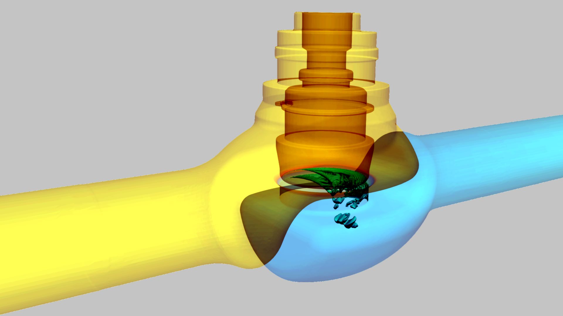 Predicting valve cavitation using CFD