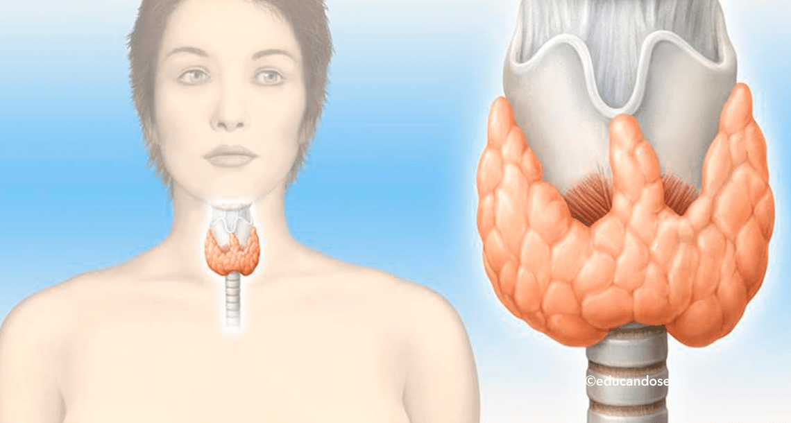 ¿Qué es el hipotiroidismo? Te diremos como identificarlo y cuál es su