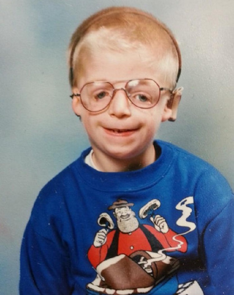 Il a été abandonné par ses parents à cause de son visage défiguré, mais