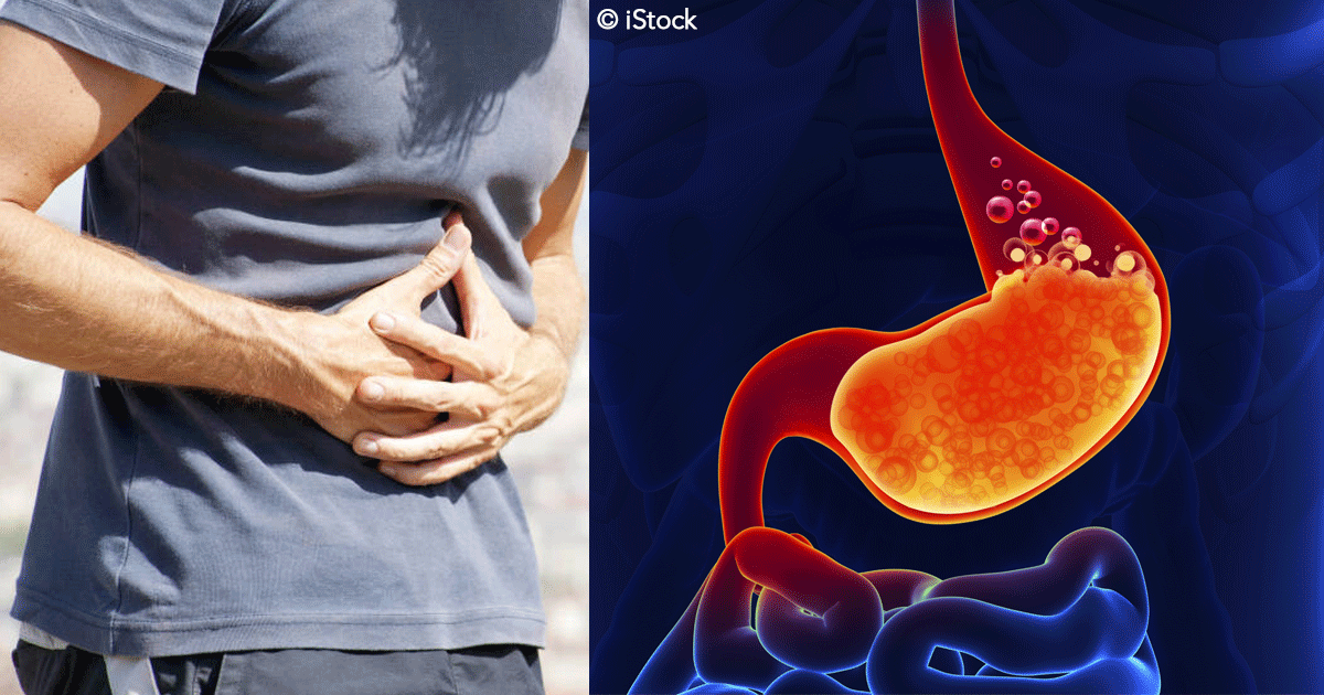 Acidez estomacal ¿qué es y cómo tratarla? Va a gustarme