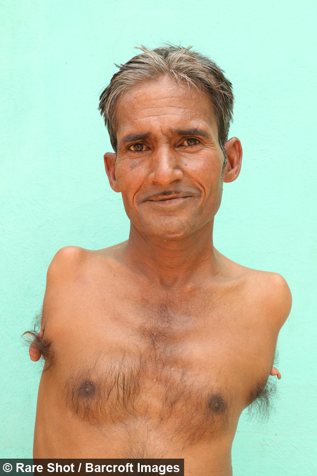 Man Without Arms Who Is Now A Professional Tailor Has Opened Up