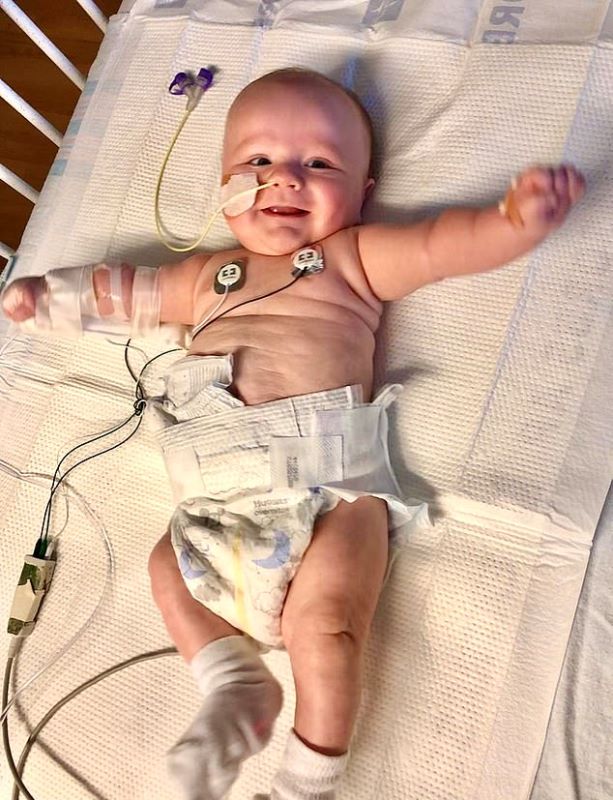 Baby Boy’s Bladder Ballooned In Size And ‘Crushed His Kidney’ Due To A Rare Medical Condition
