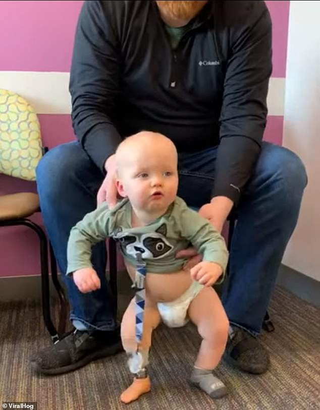 Boy Who Was Born With One Leg Danced With Joy After His Prosthetic