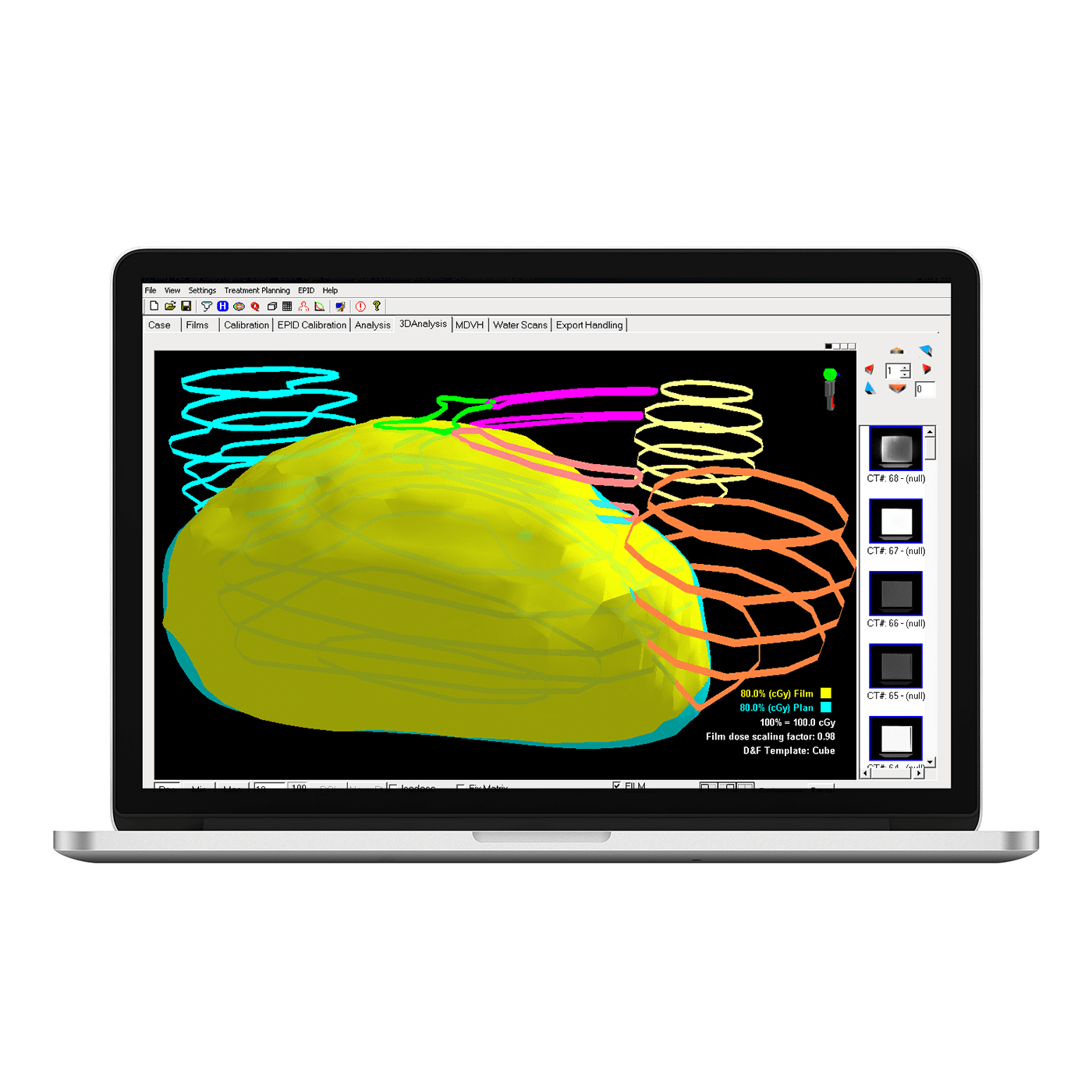 CatPhan 500 Standard Imaging