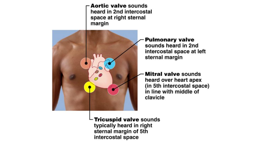 Heart Sounds S1 S2 S3 S4 Pearson+ Channels