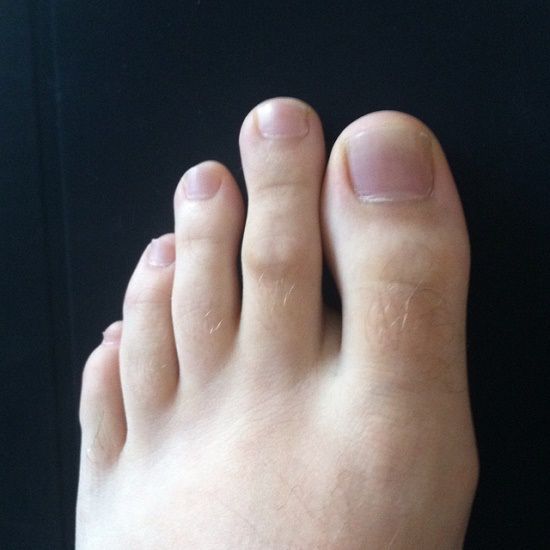 What Do Your Toes Tell You About Your Personality? ThatViralFeed