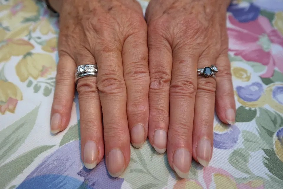 Covid nails — These changes to your fingernails can show if you’ve had
