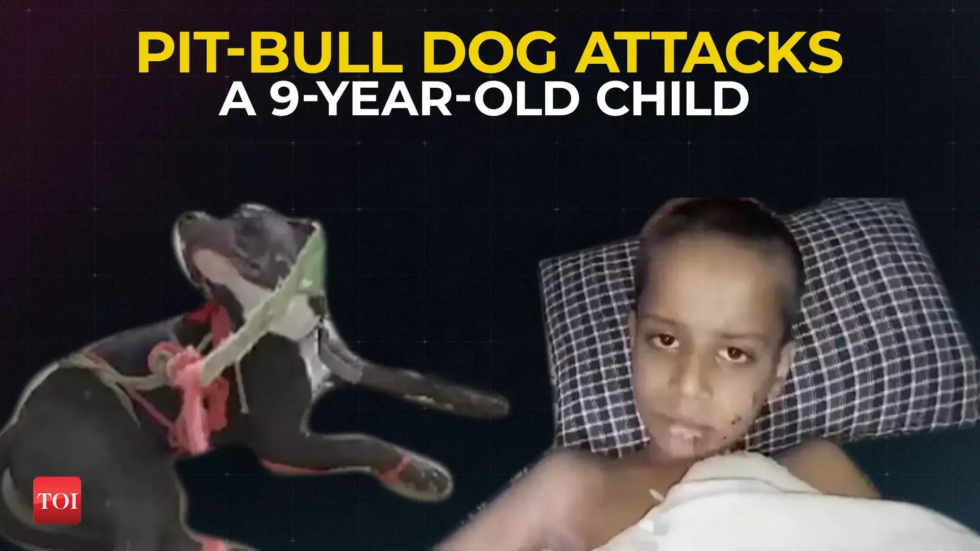 Meerut (UP) PitBull Dog attacks a 9yearold child playing outside