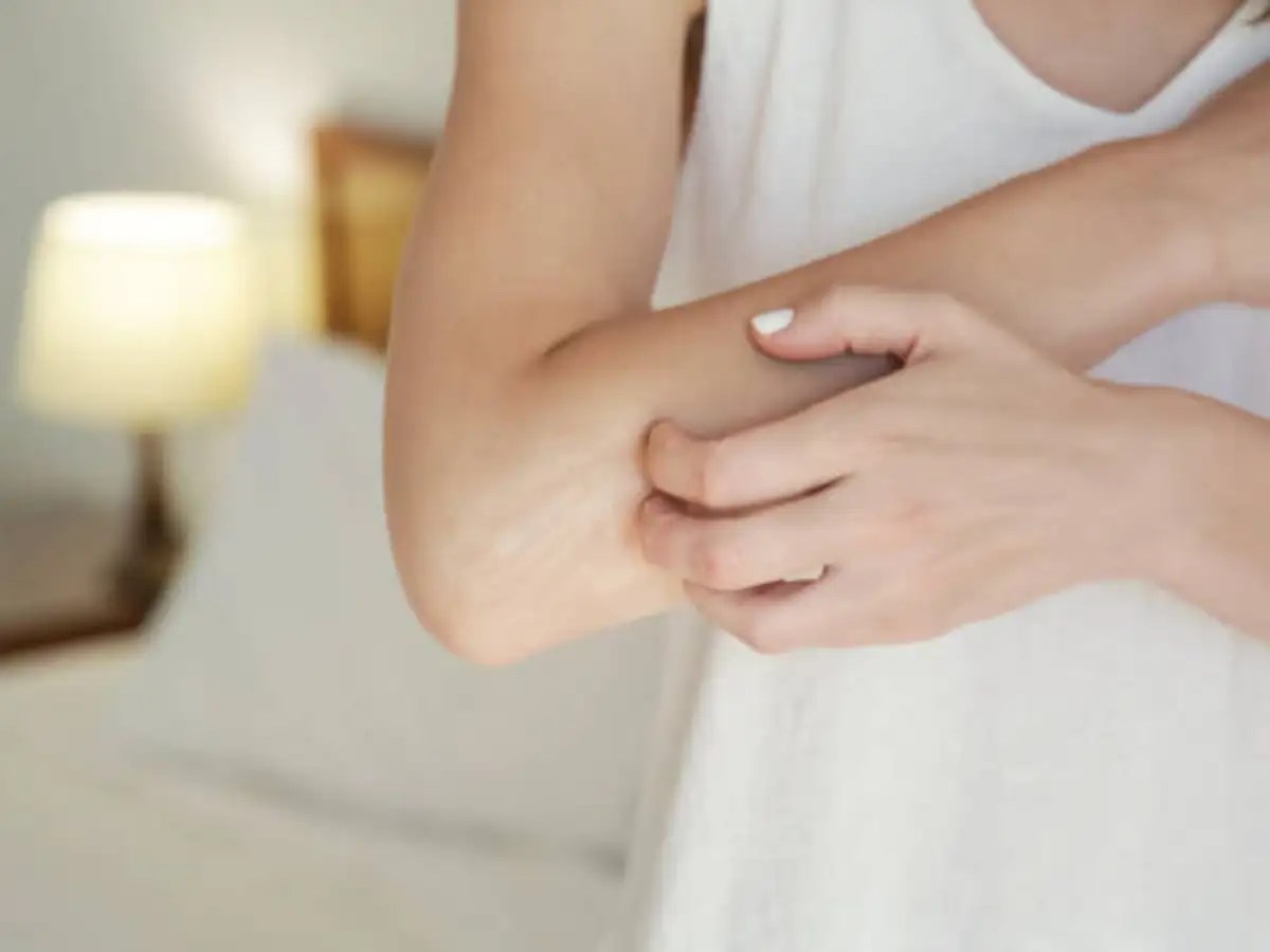 Dry skin despite drinking sufficient water? Read this | The Times of India