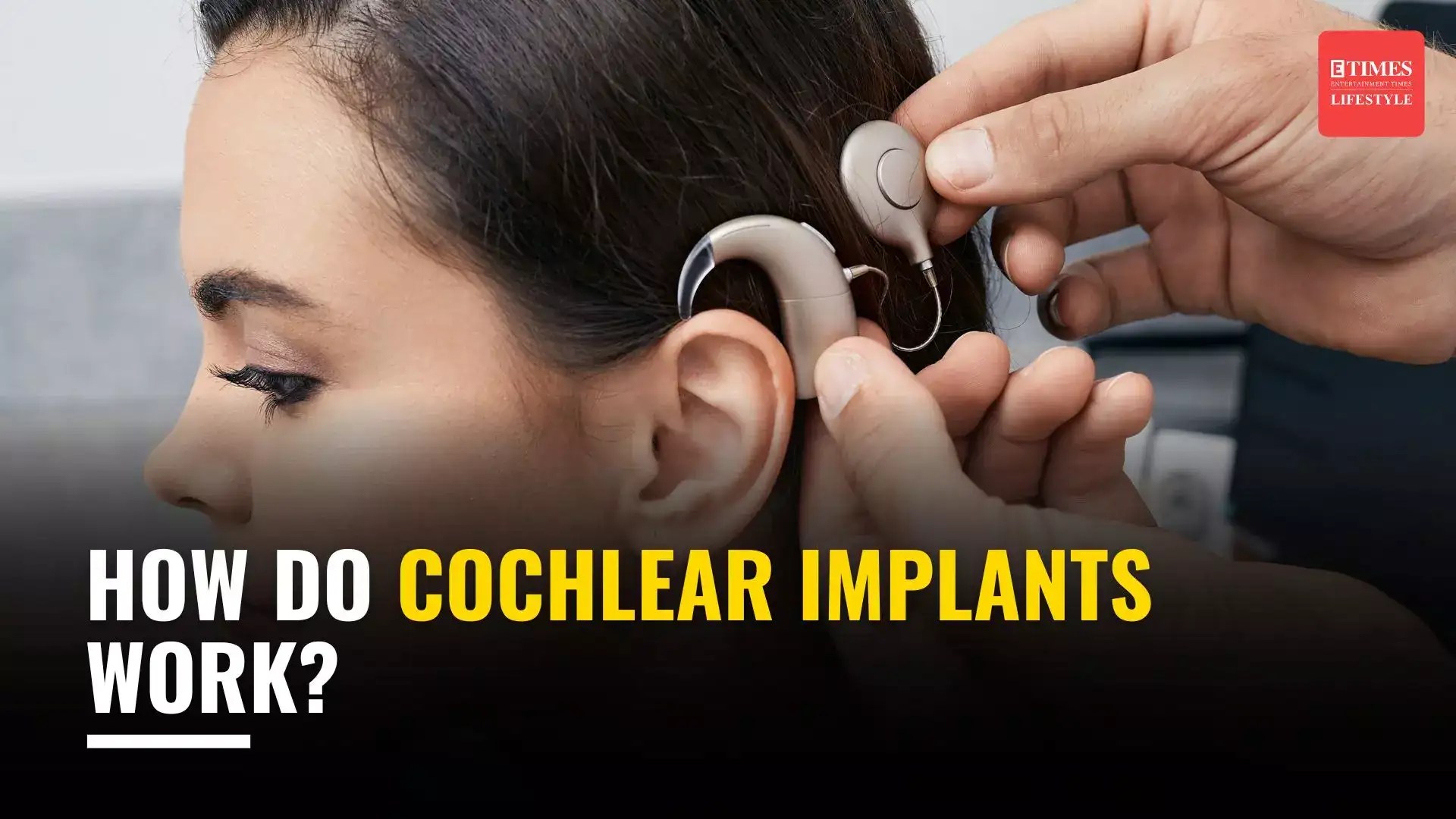 How do Cochlear implants work?