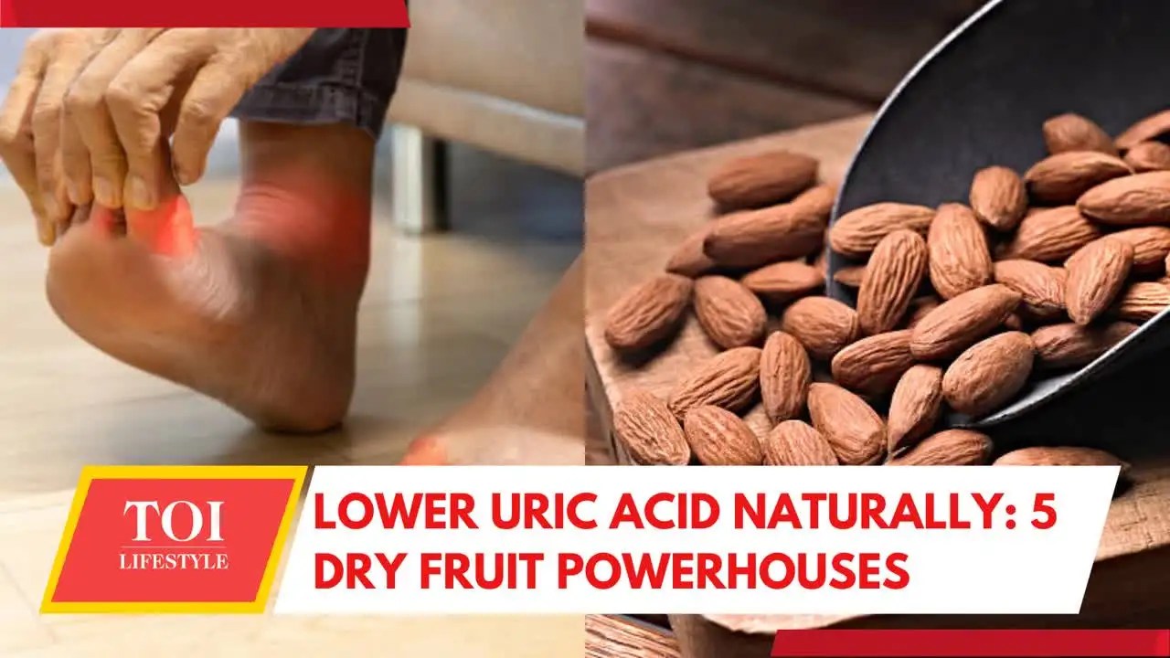 Top Dry Fruits to Lower Uric Acid Levels A Healthy Snack Option