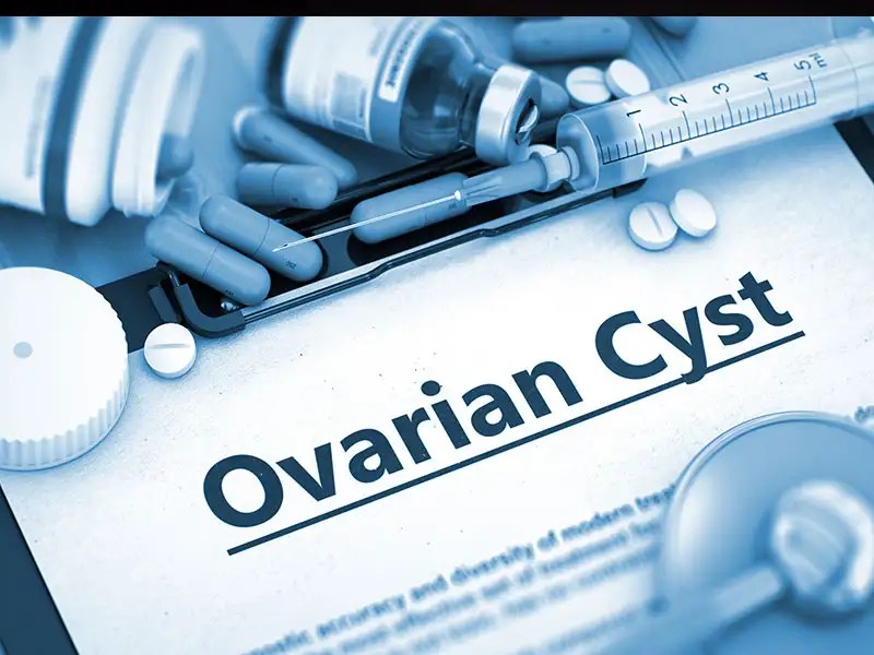 Natural Remedies For Ovarian Cysts And Fibroids cloudshareinfo