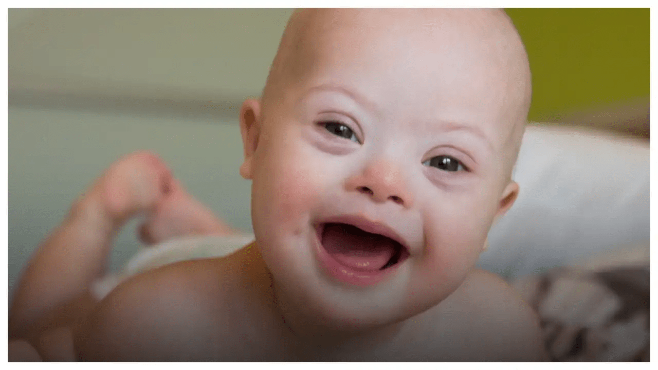 Study suggests risk of leukemia higher in children with Down syndrome