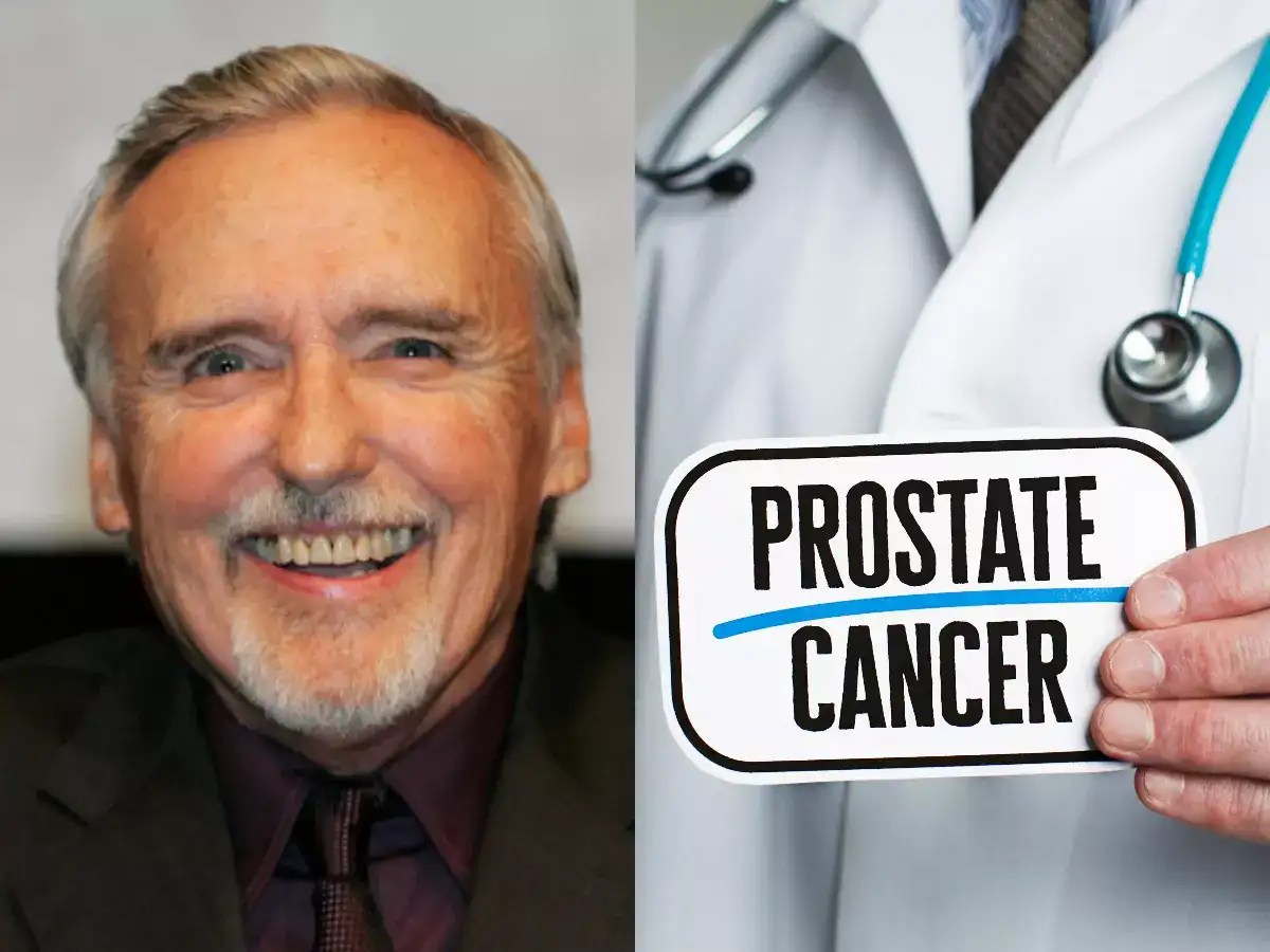 Actor Dennis Hopper’s prostate cancer diagnosis came too late; here’s