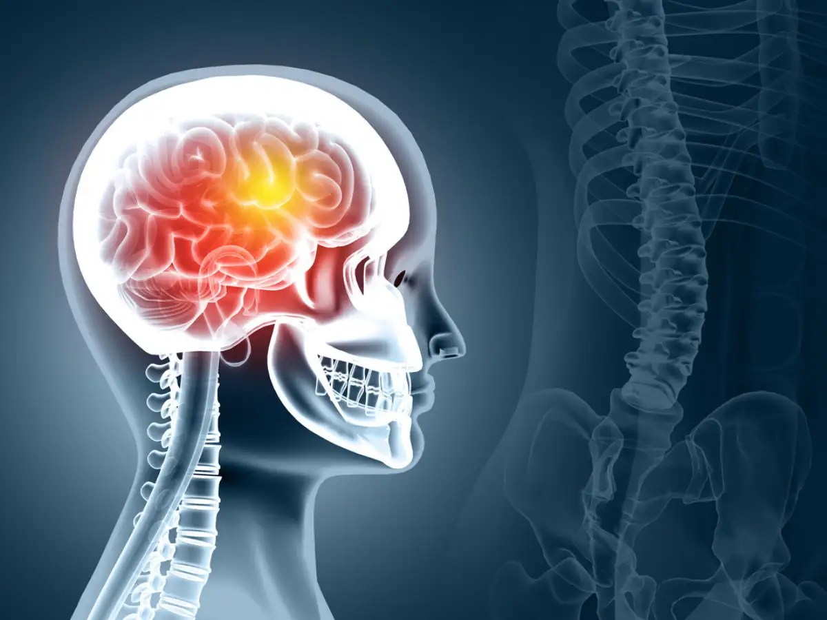 Coronavirus PostCOVID there can be complications in brain, says AIIMS