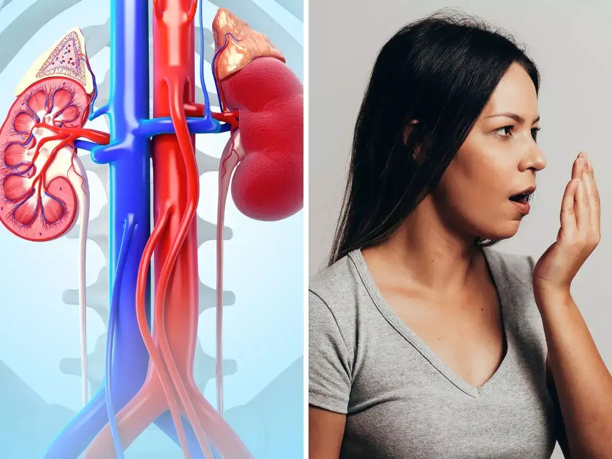 Unhealthy Human Kidney