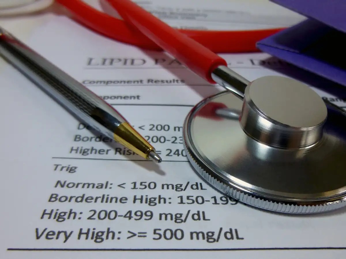 High cholesterol warning THESE are the first four noticeable signs of