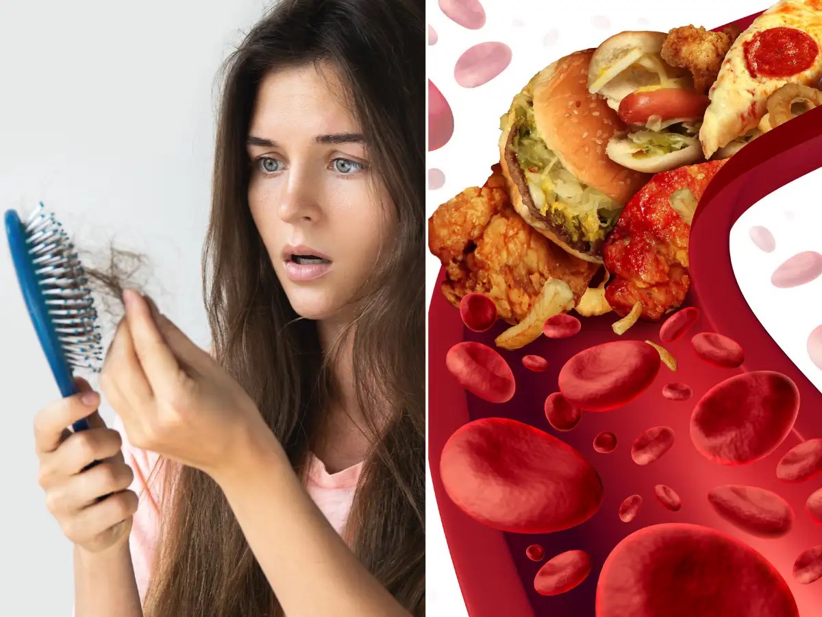 High cholesterol symptoms THESE two changes in your hair may be warning signs