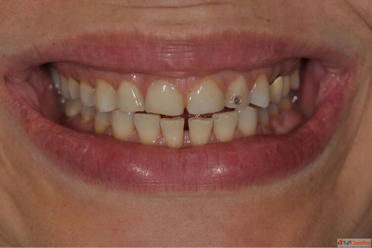 Free Classifieds Ads In India Buy/Sell/Rent Tuffclassified