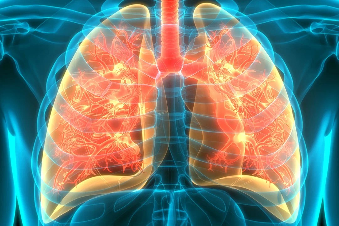The dangers of flying with damaged lungs how can you fly safely with