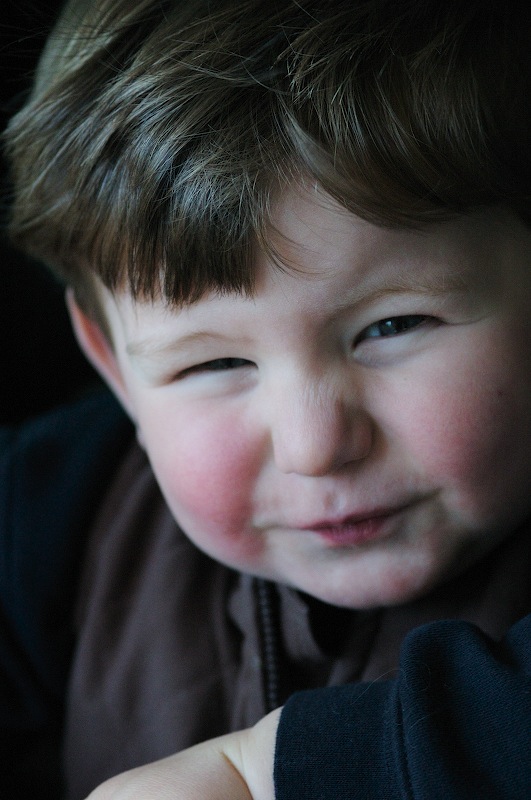 Squinty Eyes MiFOCALS