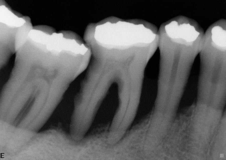 Photo Gallery perioimplantes