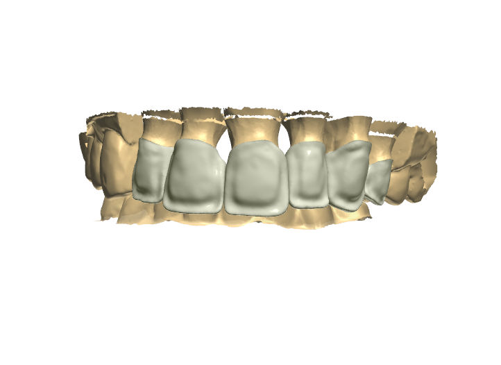 Northshore Dental Labs CAD/CAM